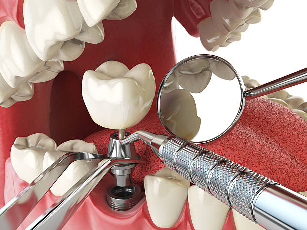 , KY Emergency Dentist Company